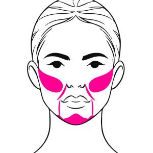 Structural Rejuvenation