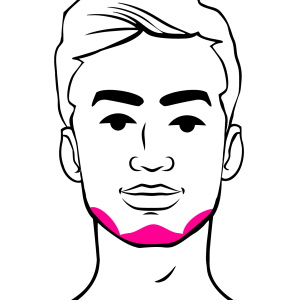 Jawline and Chin Filler