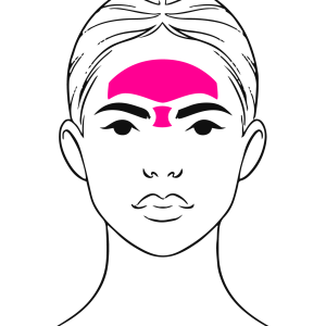 Forehead & Frown Line Correction with Filler