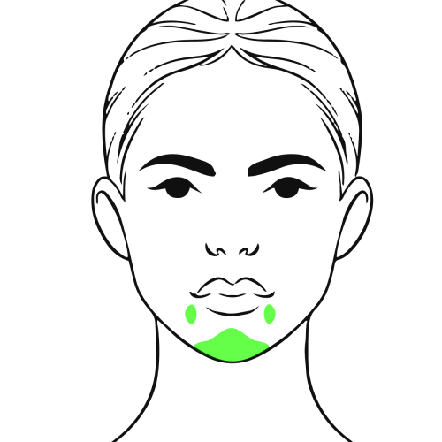 BOTOX_PEBBLED_CHINANDMOUTH