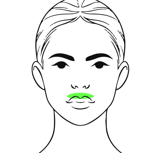 BOTOX_GUMMY_SMILE