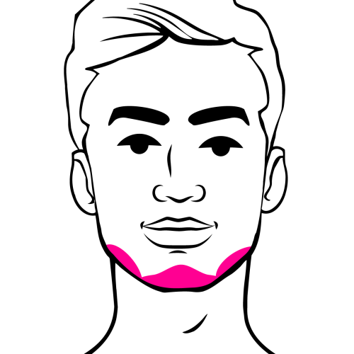 Chin_Jawline_Filler_Graphic